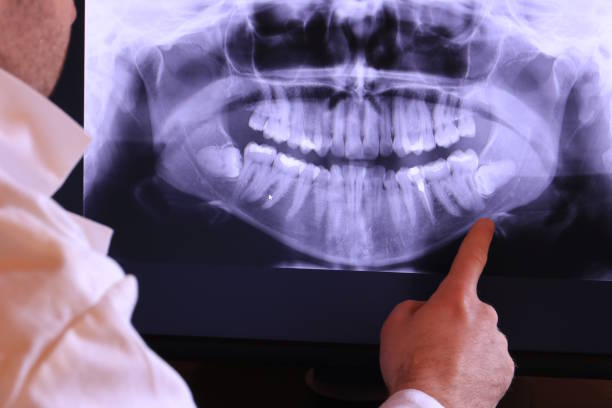 Best Emergency Treatment for Dental Infections or Abscesses in Mountain View, AR